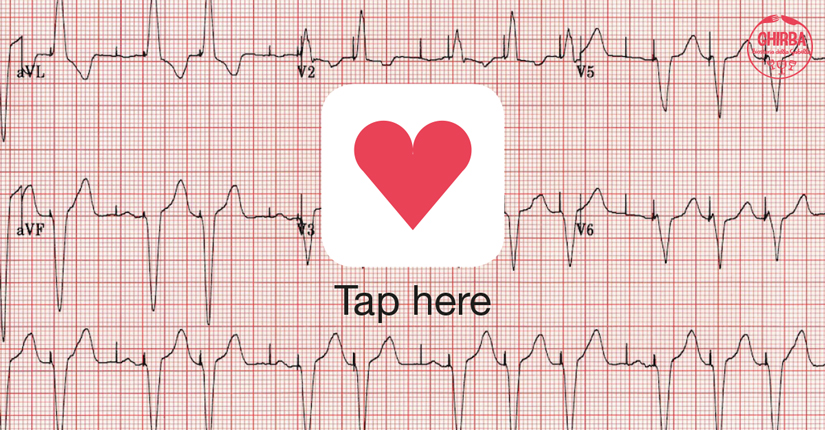 Love check // Mostra elettroaffettiva